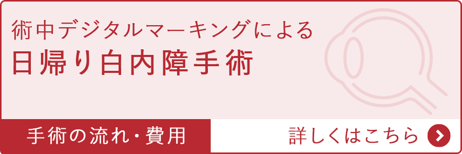 術中デジタルマーキングによる日帰り白内障手術
